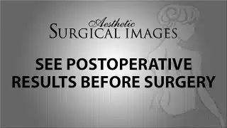 Is computer or 3D imaging utilized to help visualize post-operative results?