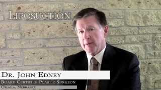 Liposuction: Recovery Following Surgery