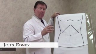 Tummy Tuck: A Step-by-Step Look