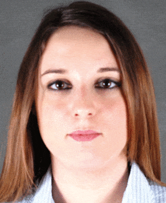 rhinoplasty - patient 5776 - before 1 rhinoplasty - patient 5776 - before 1