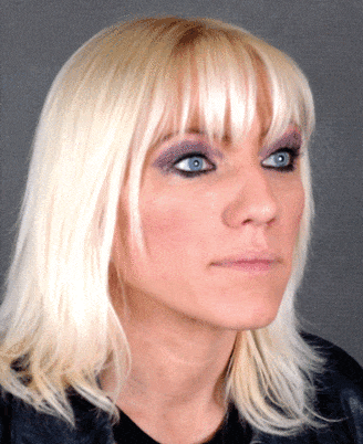 rhinoplasty - patient 5857 - before 2 rhinoplasty - patient 5857 - before 2