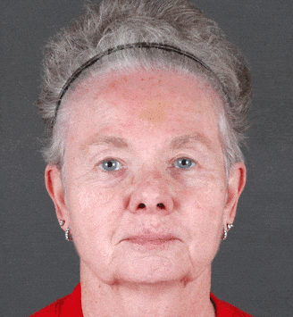 obagi skin care - patient 6104 - after 1 obagi skin care - patient 6104 - after 1