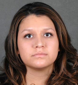 rhinoplasty - patient 5812 - after 1 rhinoplasty - patient 5812 - after 1