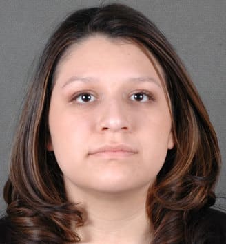 rhinoplasty - patient 5812 - before 1 rhinoplasty - patient 5812 - before 1
