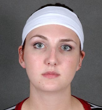 rhinoplasty - patient 5825 - before 1 rhinoplasty - patient 5825 - before 1