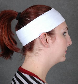 rhinoplasty - patient 5825 - before 3 rhinoplasty - patient 5825 - before 3