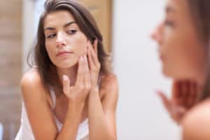 facial bruising plastic surgery