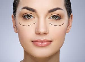 Management of Blepharoplasty Incisions