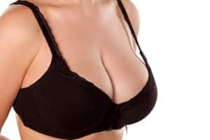 What to Expect after Breast Augmentation Surgery
