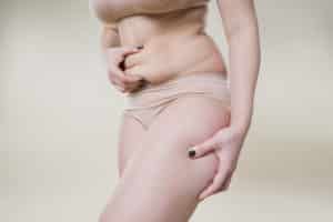 Does liposuction tighten loose skin?