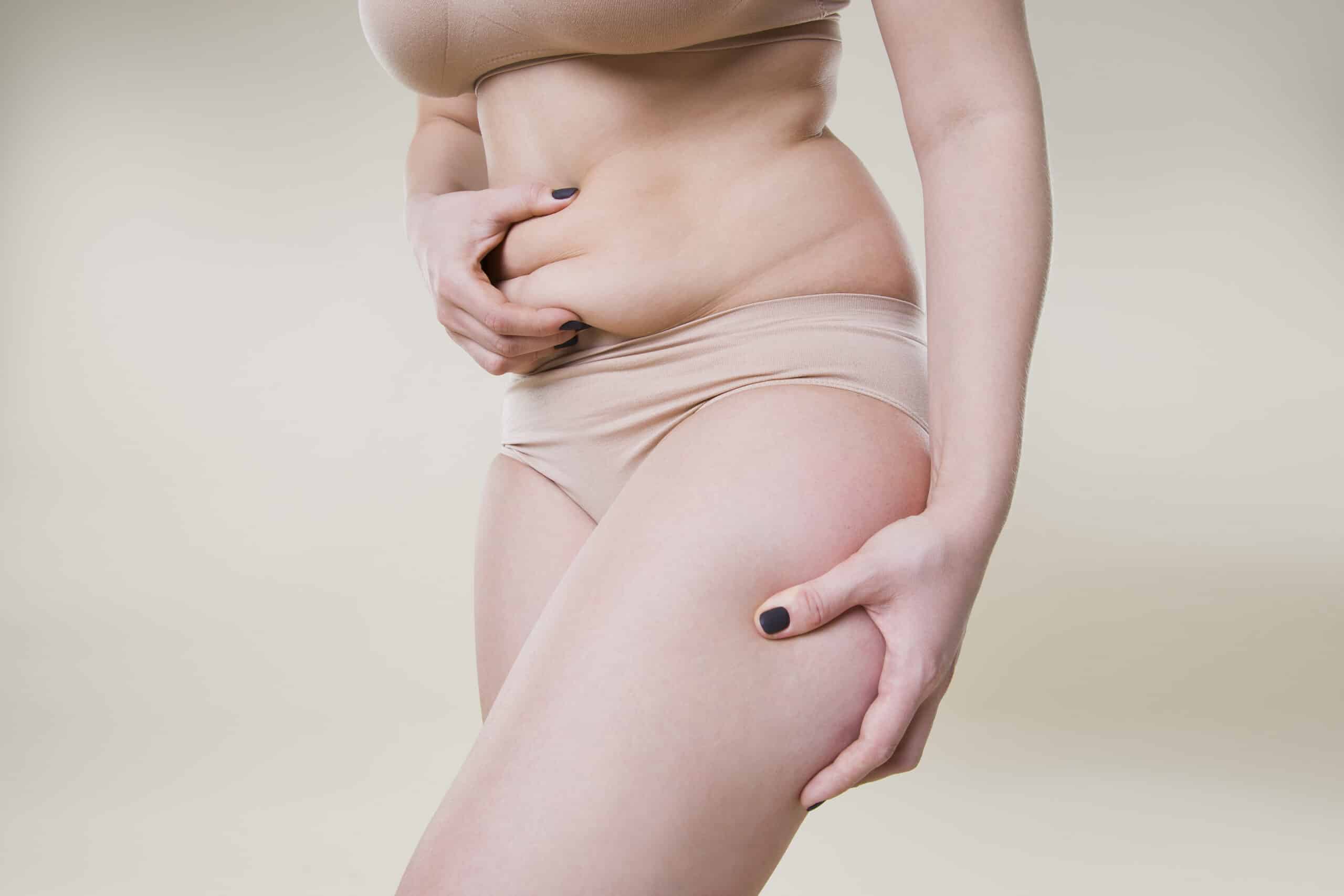 Does liposuction tighten loose skin?