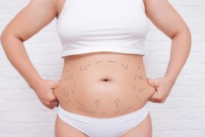 Body contouring can be performed on various areas of the body