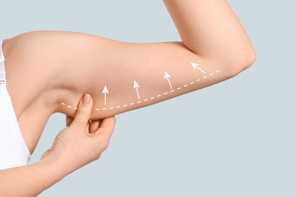 Tips and Tricks for a Successful Arm Lipo Recovery