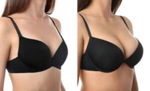 Explore the distinct benefits of breast lift and augmentation with expert insights from Aesthetic Surgical Images' surgeons.