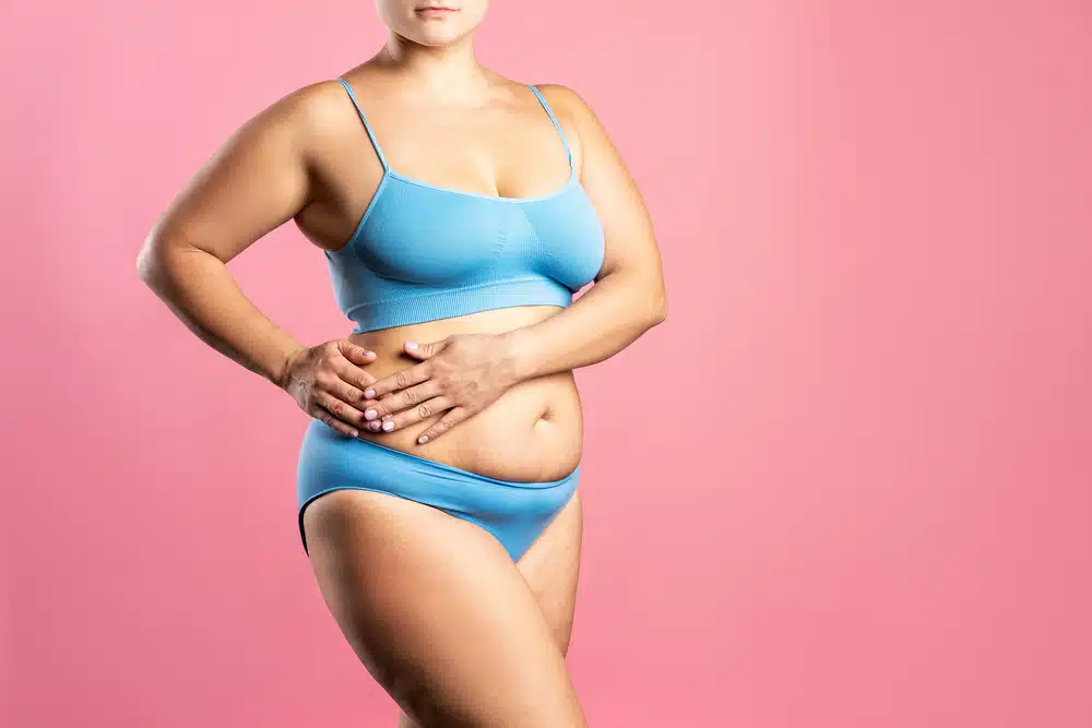 Aesthetic Surgical Images' plastic surgeons delve into potential tummy tuck complications, specifically addressing post-abdominoplasty fat necrosis concerns.