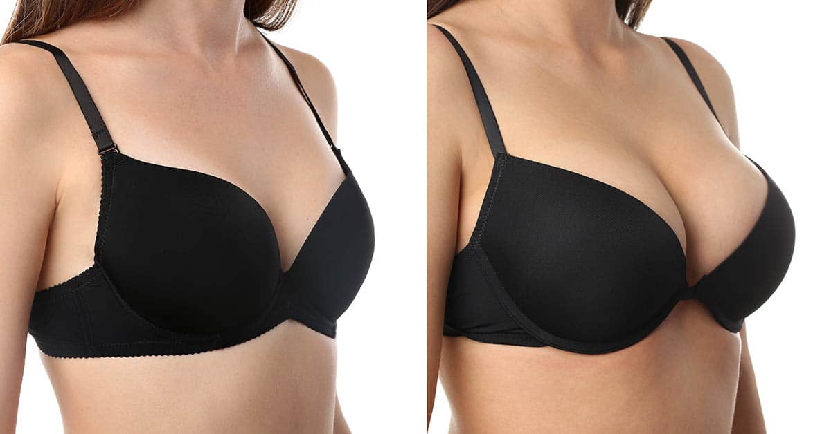 Breast Augmentation Omaha, NE | Aesthetic Surgical Images