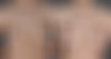 Breast Augmentation Before and After Photos in Omaha, NE, Case 21642