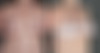 Breast Reduction Before and After Photos in Omaha, NE, Case 22179